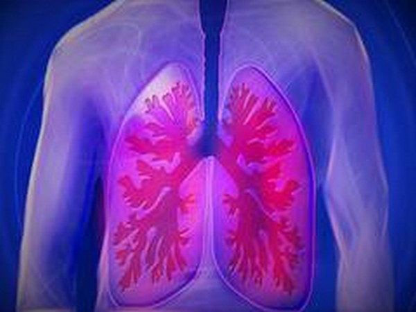 Study sheds light on rare genetic variants that increase risk for lung cancer